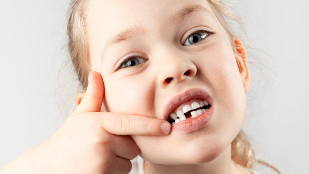 Baby tooth fell out. Portrait of small girl with a missing first tooth (knocked-out tooth child)