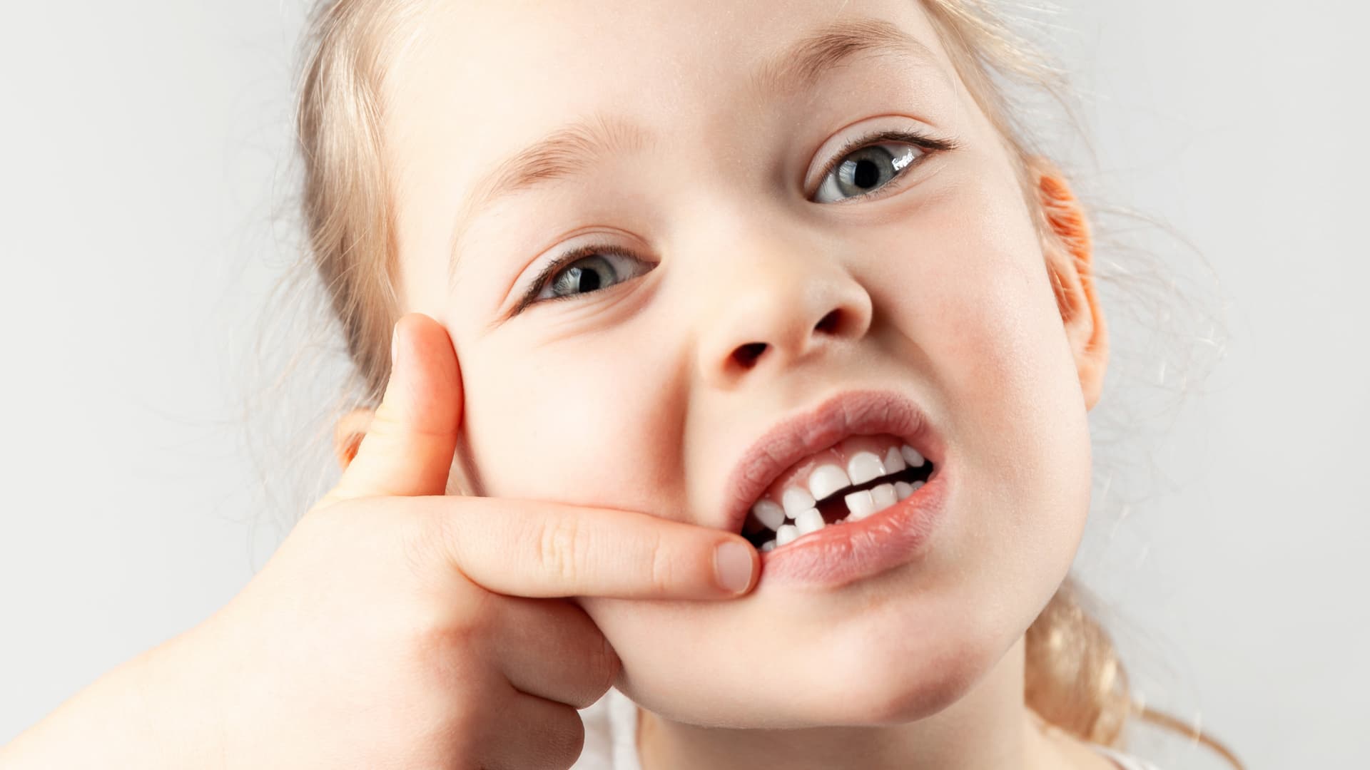 Baby tooth fell out. Portrait of small girl with a missing first tooth