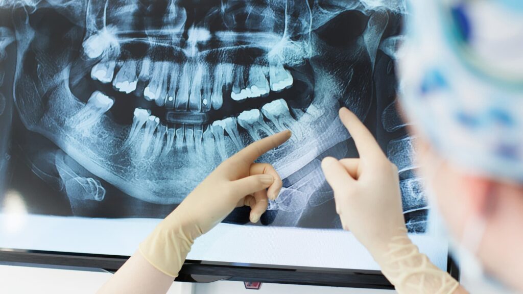 Dental X-rays radiation safety