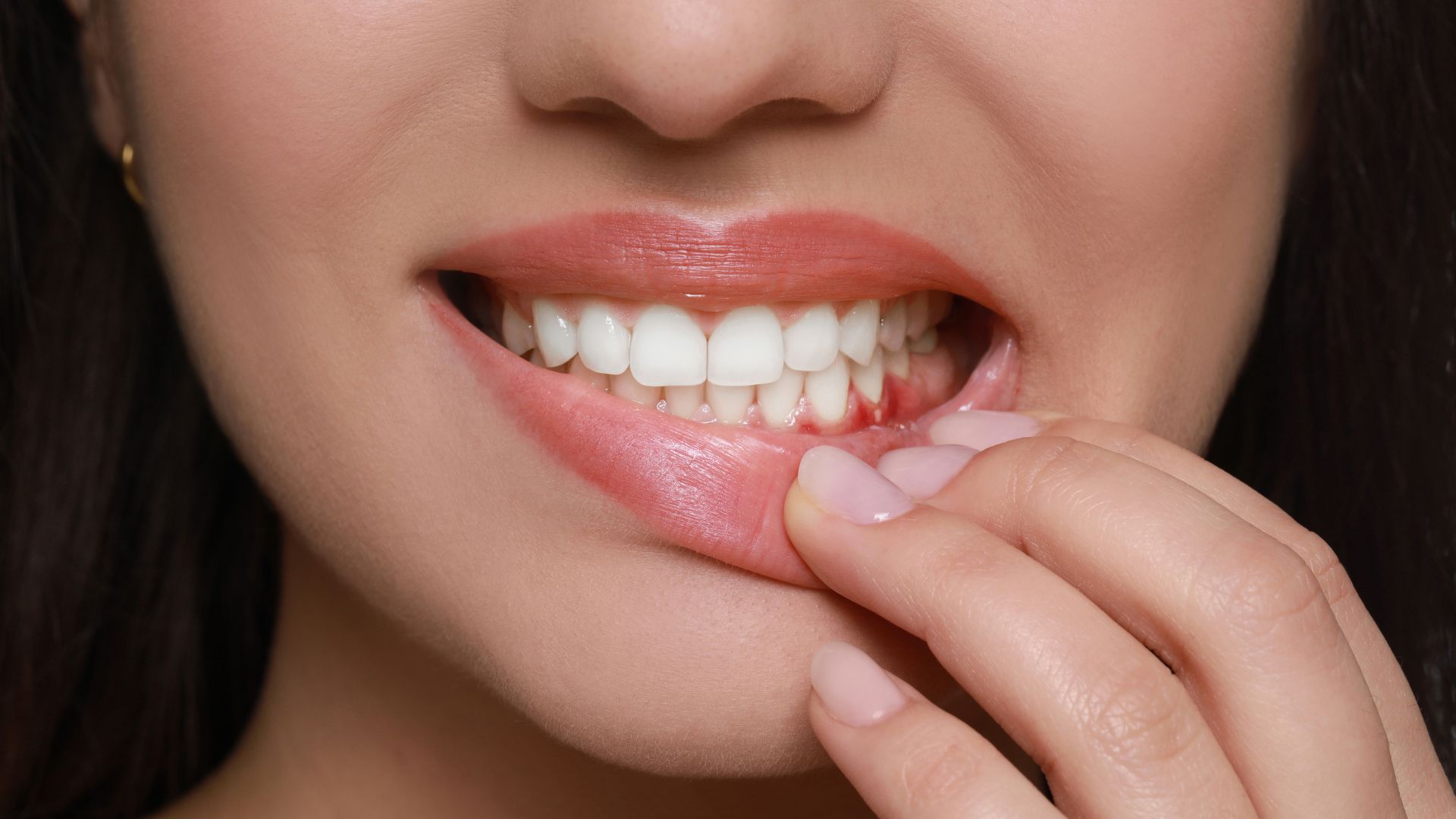 Young Woman Showing gum problems