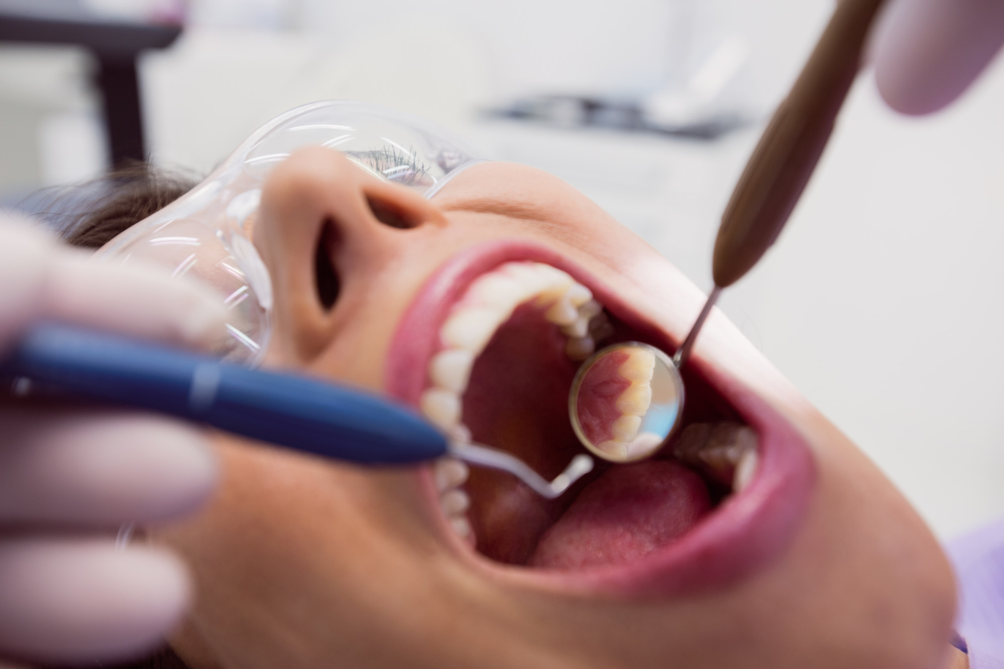 A dentist performing a root canal procedure on a female patient, using dental tools to examine her teeth during treatment