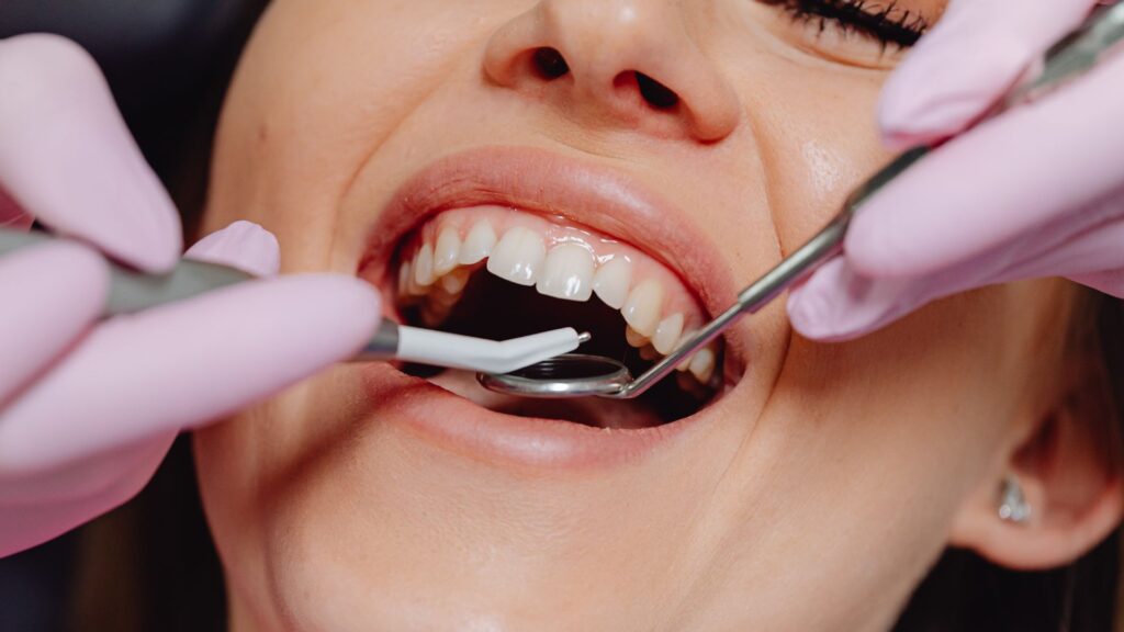 tooth replacement Christchurch