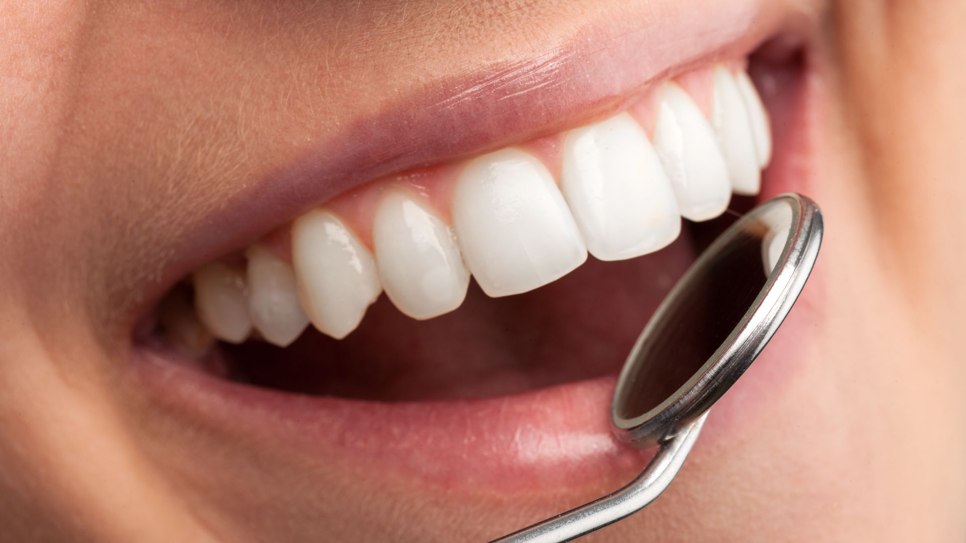 Close-up of a dental mirror examining clean, healthy teeth—care provided by a gentle dentist in Christchurch.