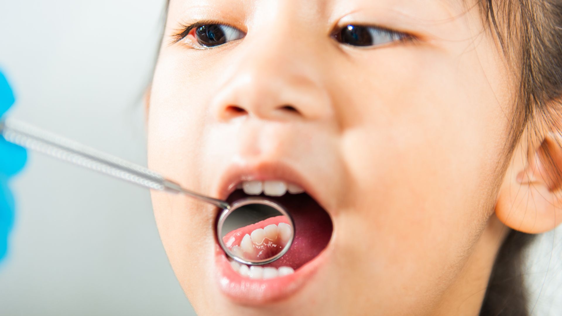 Children Oral Health Christchurch
