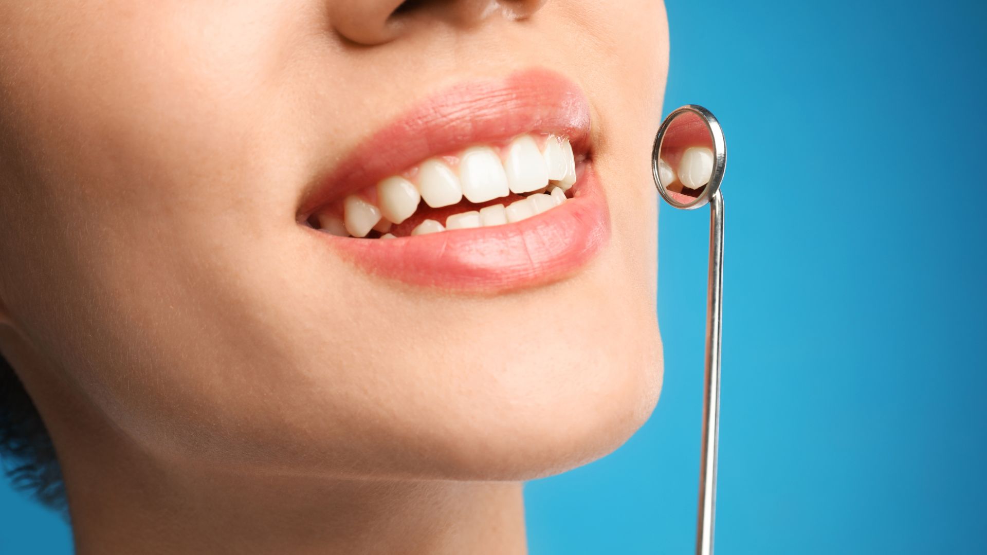 Preventive Dentistry Christchurch