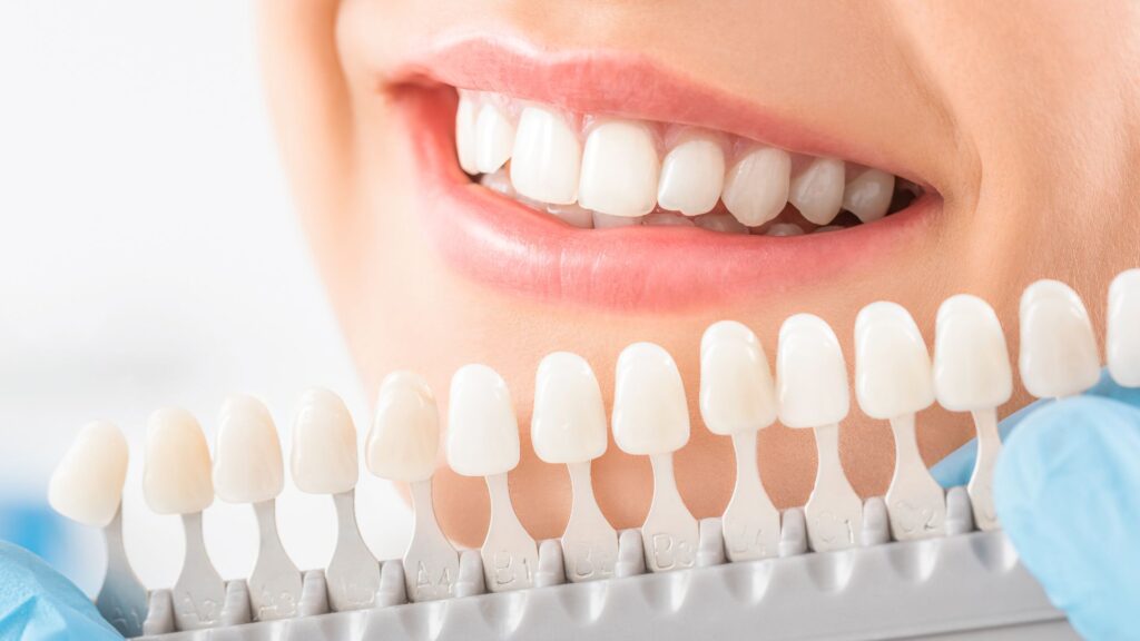 Teeth Whitening Dentist in Christchurch