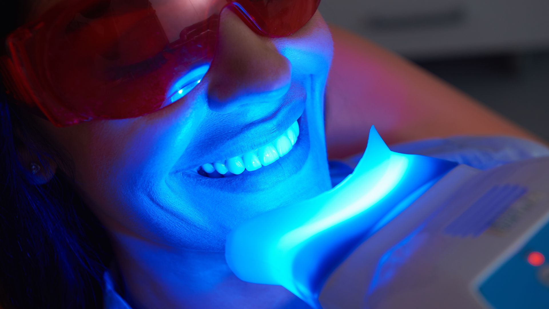 professional teeth whitening in Christchurch