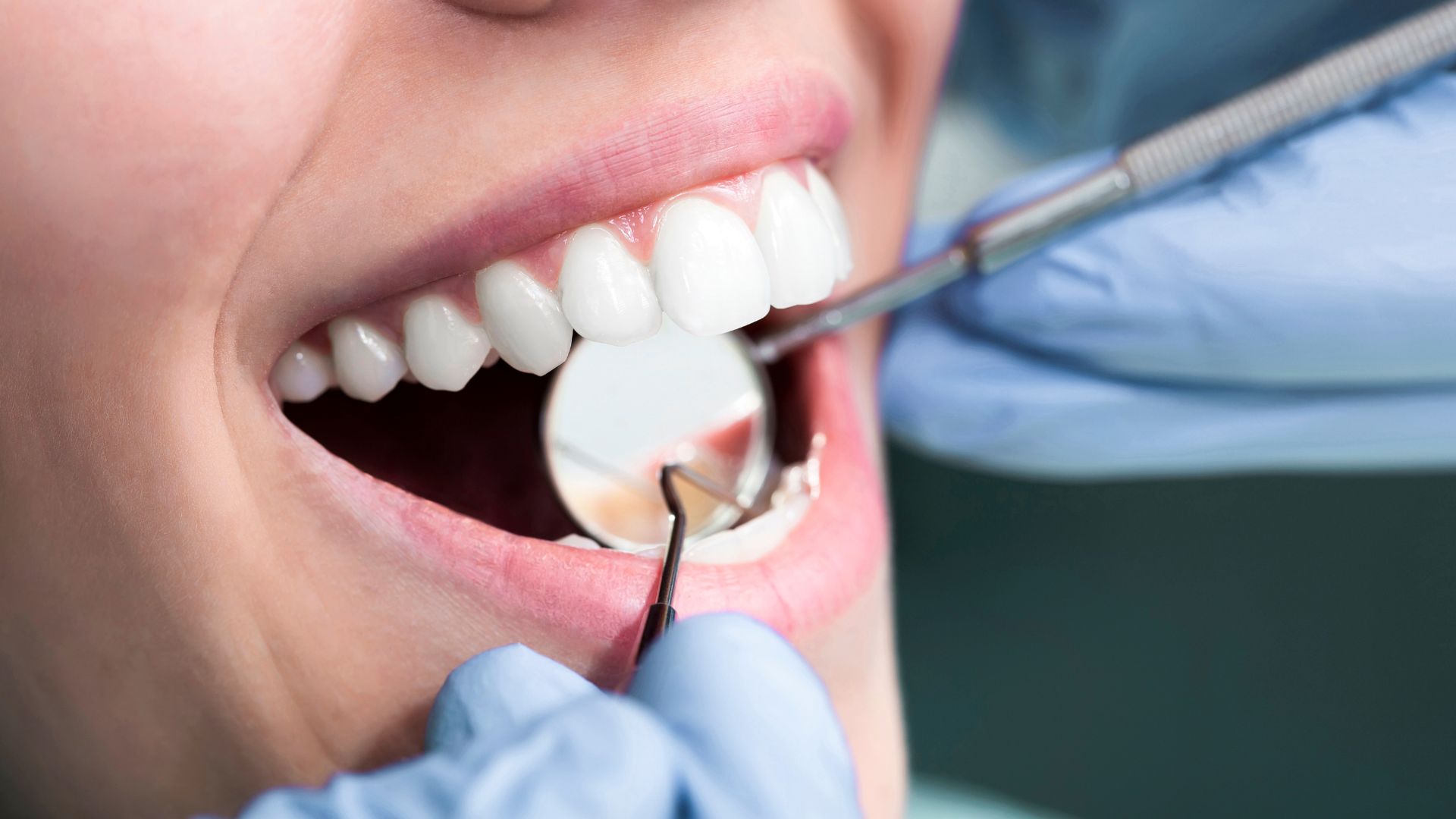 common dental problems Christchurch