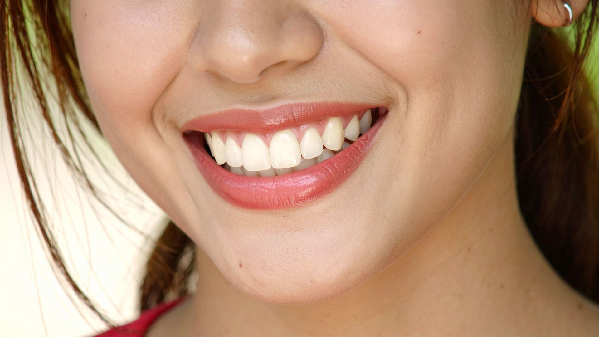 professional teeth whitening Christchurch