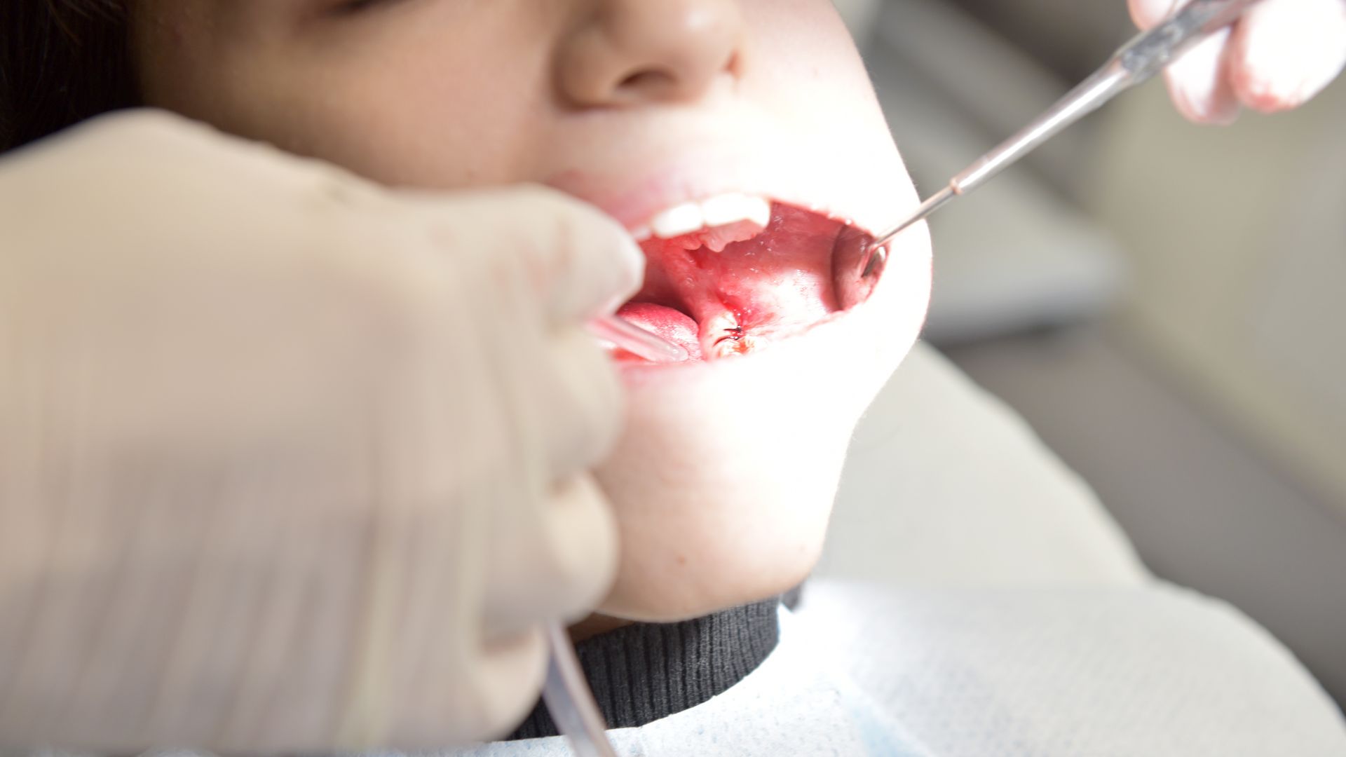damaged tooth treatment Christchurch